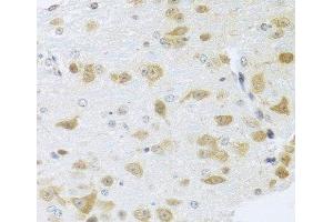 Immunohistochemistry of paraffin-embedded Mouse brain using Gm13125 Polyclonal Antibody at dilution of 1:100 (40x lens). (Pramel15 Antikörper)
