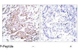 Image no. 1 for anti-Myc Proto-Oncogene protein (MYC) (pThr58) antibody (ABIN196672) (c-MYC Antikörper  (pThr58))