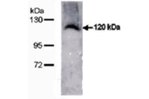 TMEM67 Antikörper  (C-Term)