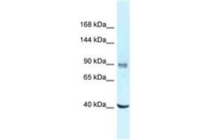 Image no. 1 for anti-DEAD (Asp-Glu-Ala-Asp) Box Polypeptide 23 (DDX23) (AA 662-711) antibody (ABIN6747808)