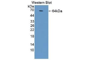 Detection of Recombinant MyD88, Rat using Polyclonal Antibody to Myeloid Differentiation Factor 88 (MyD88) (MYD88 Antikörper  (AA 1-296))