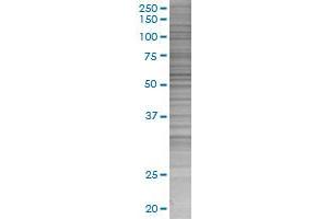 Western Blotting (WB) image for RXRG 293T Cell Transient Overexpression Lysate(Denatured) (ABIN1333373)