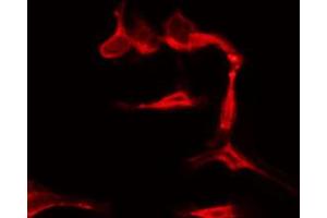 ABIN6274446 staining COLO205 by IF/ICC. (GRK7 Antikörper  (Internal Region))