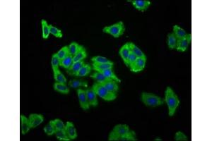 Immunofluorescence staining of HepG2 cells with ABIN7169920 at 1:166, counter-stained with DAPI. (SCN11A Antikörper  (AA 403-551))