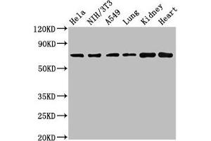 Western Blot Positive WB detected in: Hela whole cell lysate, NIH/3T3 whole cell lysate, A549 whole cell lysate, Rat lung tissue, Rat kidney tissue, Mouse heart tissue All lanes: ARHGAP18 antibody at 4.