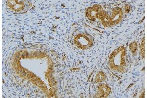 ABIN6276486 at 1/100 staining Human uterus tissue by IHC-P. (RNASE12 Antikörper  (Internal Region))