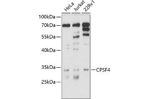 Western blot analysis of extracts of various cell lines, using CPSF4 antibody (ABIN6130128, ABIN6138972, ABIN6138973 and ABIN6214478) at 1:1000 dilution. (CPSF4 Antikörper  (AA 1-244))
