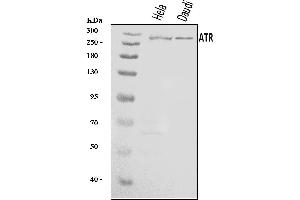 Western blot analysis of ATR using anti-ATR antibody (ABIN7602394).