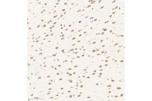 Immunohistochemistry of paraffin embedded mouse brain using AZI2 (ABIN7072856) at dilution of 1:650 (300x lens) (AZI2 Antikörper)
