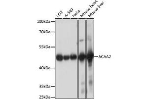 Western blot analysis of extracts of various cell lines, using  antibody (ABIN7265368) at 1:1000 dilution. (ACAA2 Antikörper  (AA 1-250))