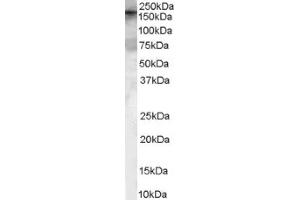 Image no. 1 for anti-rho Guanine Nucleotide Exchange Factor (GEF) 5 (ARHGEF5) (Internal Region) antibody (ABIN374647) (ARHGEF5 Antikörper  (Internal Region))
