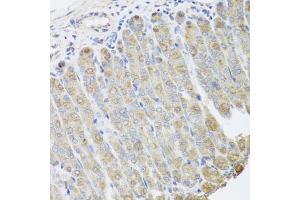 Immunohistochemistry of paraffin-embedded mouse stomach using BGLAP antibody (ABIN5975009) at dilution of 1/100 (40x lens). (Osteocalcin Antikörper)