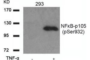 Western Blotting (WB) image for anti-Nuclear Factor of kappa Light Polypeptide Gene Enhancer in B-Cells 1 (NFKB1) (pSer932) antibody (ABIN7138734)
