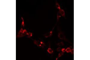 ABIN6274871 staining NIH-3T3 cells by IF/ICC. (Ataxin 2-Like Antikörper  (Internal Region))