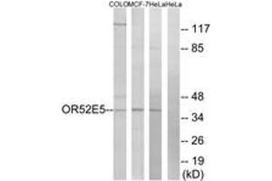 Western blot analysis of extracts from COLO/MCF-7/HeLa cells, using OR52E5 Antibody. (OR52E5 Antikörper  (AA 199-248))