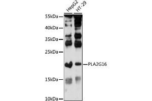 Western blot analysis of extracts of various cell lines, using PLG16 antibody (ABIN7267786) at 1:1000 dilution. (PLA2G16 Antikörper  (AA 68-162))