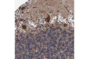 Immunohistochemical staining of human cerebellum with AGAP2 polyclonal antibody  shows distinct cytoplasmic positivity in Purkinje cells. (AGAP2 Antikörper)