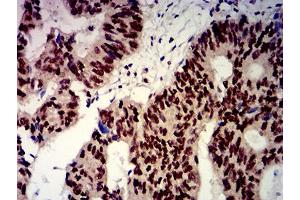 Immunohistochemistry (IHC) image for anti-beta-Transducin Repeat Containing (BTRC) (AA 24-151) antibody (ABIN5611131)