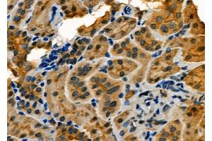 ABIN6264138 and ABIN6273148 at 1/100 staining Rat kidney tissue by IHC-P. (PER2 Antikörper  (Internal Region))