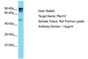 Image no. 1 for anti-Protein Tyrosine Phosphatase G1 (PTPN12) (AA 591-640) antibody (ABIN6750360) (PTPN12 Antikörper  (AA 591-640))