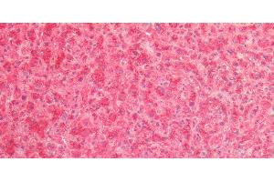 Immunohistochemistry of paraffin-embedded Human Liver using Cathepsin B Polyclonal Antibody at dilution of 1:80. (Cathepsin B Antikörper)