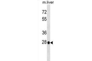 Western Blotting (WB) image for anti-Homeobox B5 (HOXB5) antibody (ABIN2999364) (HOXB5 Antikörper)