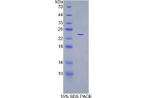 SDS-PAGE analysis of Human CDC25B Protein.