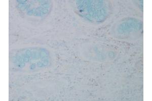Immunohistochemistry analysis using Mouse Anti-Nitrotyrosine Monoclonal Antibody, Clone 39B6 . (Nitrotyrosine Antikörper  (Biotin))