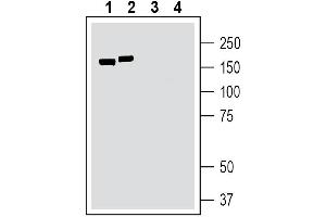 anti-Transmembrane Channel-Like 1 (TMC1) (Extracellular) antibody