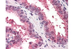 Anti-RAD23B antibody IHC of human prostate. (RAD23B Antikörper  (AA 163-176))