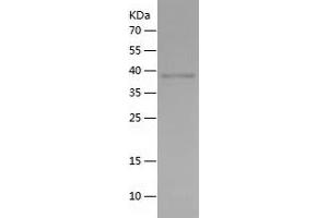 Western Blotting (WB) image for Sirtuin 1 (SIRT1) (AA 510-747) protein (His tag) (ABIN7282004) (SIRT1 Protein (AA 510-747) (His tag))