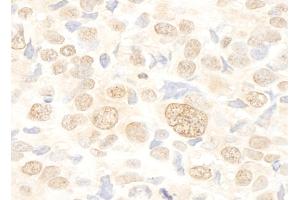 Immunohistochemistry (IHC) image for anti-serine/arginine-Rich Splicing Factor 10 (SRSF10) (AA 133-183) antibody (ABIN7449386) (SRSF10 Antikörper  (AA 133-183))