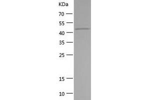 Western Blotting (WB) image for serpin Peptidase Inhibitor, Clade B (Ovalbumin), Member 4 (SERPINB4) (AA 1-390) protein (His tag) (ABIN7125050) (SERPINB4 Protein (AA 1-390) (His tag))