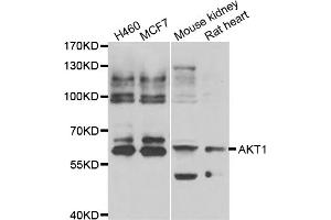 Western blot analysis of extracts of various cell lines, using AKT1 antibody (ABIN5974372). (AKT1 Antikörper)