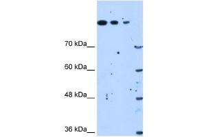 Western Blot showing SETD2 antibody used at a concentration of 1. (SETD2 Antikörper  (N-Term))