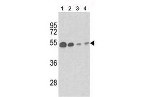 Western blot analysis of b-Tubulin antibody and (1) mouse brain tissue, (2) Y79, (3) CEM and (4) 293 lysate. (TUBB1 Antikörper)