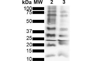 Western Blot analysis of Purified poly-ubiquitin chains showing detection of Multiple Ubiquitin protein using Rabbit Anti-Ubiquitin Monoclonal Antibody, Clone FK2 (ABIN5695815). (Ubiquitin Antikörper)