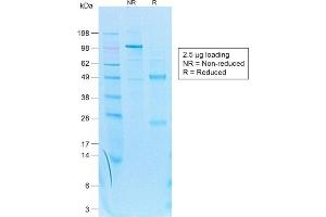 SDS-PAGE (SDS) image for anti-Keratin 7 (KRT7) antibody (ABIN6939879)