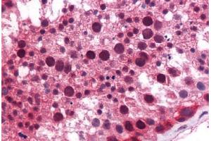 Human Testis: Formalin-Fixed, Paraffin-Embedded (FFPE) (KLF9 Antikörper  (AA 38-87))