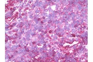 anti-Proteasome (Prosome, Macropain) 26S Subunit, Non-ATPase, 10 (PSMD10) (AA 127-226) antibody