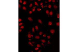 ABIN6267394 staining HeLa by IF/ICC. (RPA2 Antikörper  (pThr21))