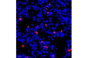 Immunofluorescent analysis of paraffin embedded mouse lung using S100A9 (ABIN7075497) at dilution of 1: 900