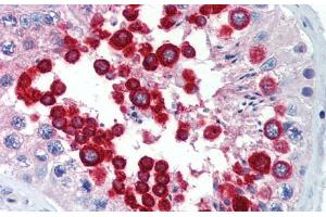 Immunohistochemistry with Human Testis lysate tissue at an Antibody concentration of 5. (JAZF1 Antikörper  (C-Term))
