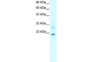 WB Suggested Anti-CLDN9 Antibody Titration:  2. (Claudin 9 Antikörper  (C-Term))