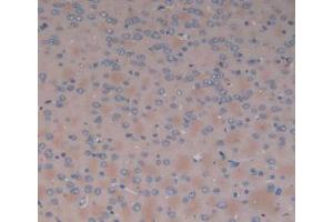 DAB staining on IHC-P; Samples: Rat Brain Tissue. (SERPINA6 Antikörper  (AA 173-344))