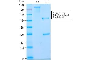 SDS-PAGE Analysis Purified Pan-Nuclear Antigen Monoclonal Antibody (NM2984R). (Rekombinanter Nuclear Antigen (Pan-Nuclear Marker) Antikörper)
