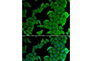 Immunofluorescence analysis of U2OS cells using SMYD2 Polyclonal Antibody (SMYD2A Antikörper)