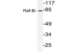 Western blot (WB) analysis of Raf-B antibody in extracts from 293 cells. (BRAF Antikörper)