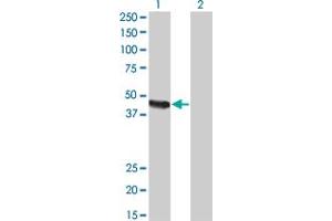 Western Blot analysis of CPA2 expression in transfected 293T cell line by CPA2 monoclonal antibody (M02), clone 2E11. (Carboxypeptidase A2 Antikörper  (AA 117-206))