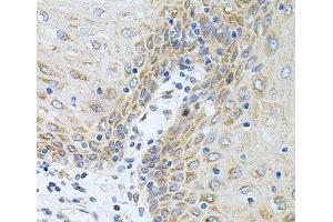 Immunohistochemistry of paraffin-embedded Human esophagus using CPM Polyclonal Antibody at dilution of 1:100 (40x lens). (CPM Antikörper)
